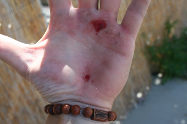 203 Joshua Tree war wound